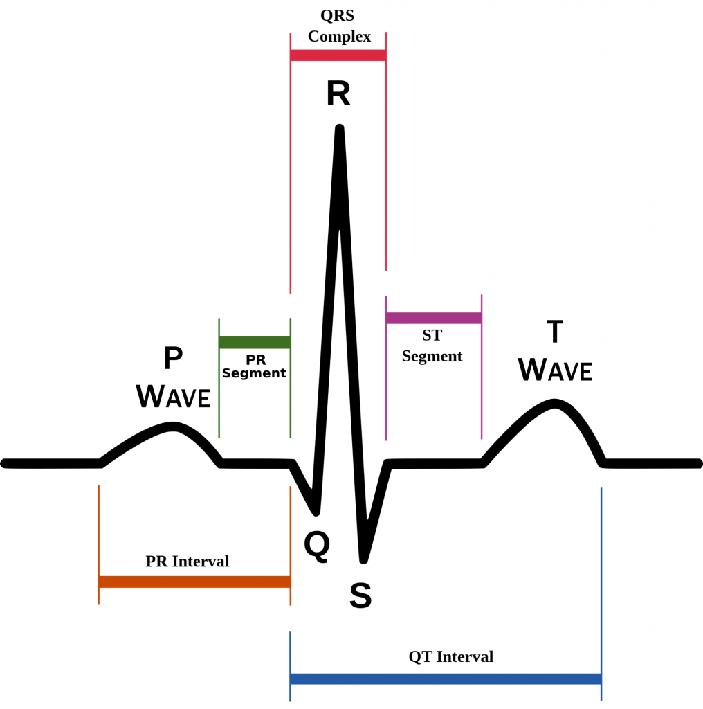 ecg Schematic-decg iagram-of-normal-sinus-rhythm-for-a-human-heart-as-seen-on-ECG-Wikipedia-free-to-use
